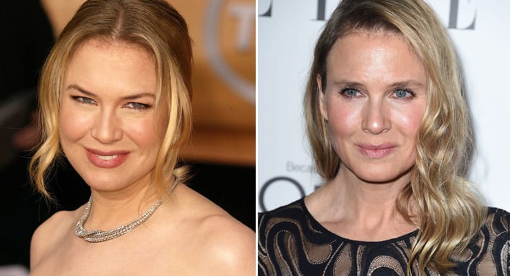 Renée Zellweger: Breytt útlit ávöxtur hamingju